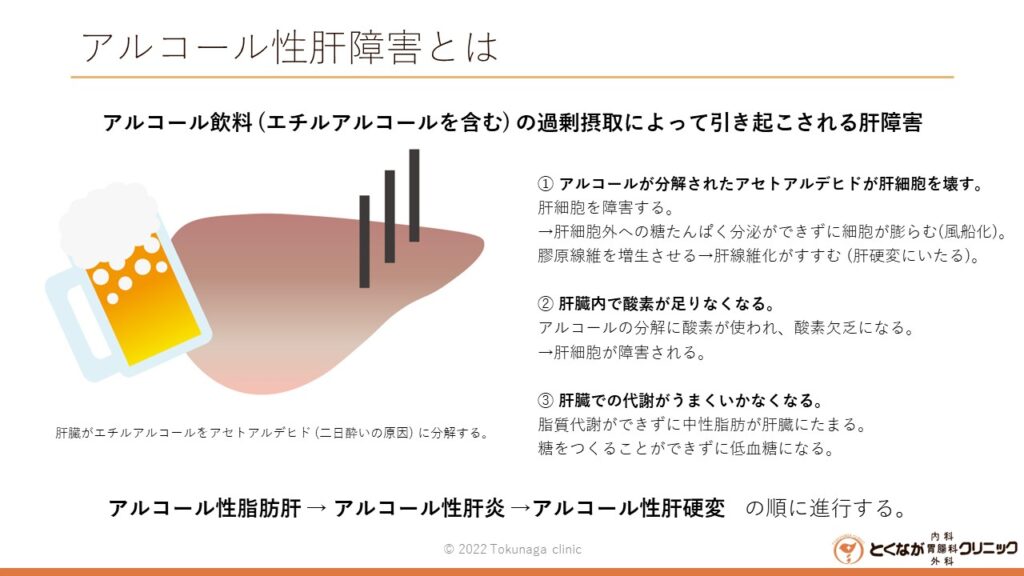 アルコール性肝疾患 の画像イメージ